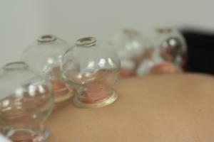 Cupping01
